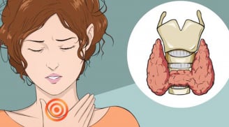 6 dấu hiệu không đau cảnh báo sớm về bệnh tuyến giáp chị em thường bỏ qua, đi khám thì đã muộn