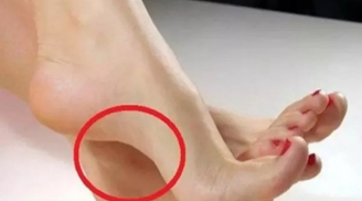 Bàn chân có một trong 7 đặc điểm này là người giỏi kiếm tiền, về già an nhàn đủ đầy