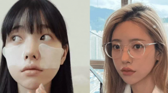 4 sai lầm tưởng đơn giản lại hại vô cùng khiến da ngày càng nhiều vết thâm sạm