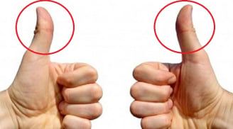Các cụ bảo: Nhìn ngón tay cái, biết ngay bạn 'giàu nứt đố đổ vách' hay 'nghèo rớt mồng tơi'