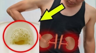 Ngủ dậy thấy nước tiểu có bọt: Cảnh báo 3 căn bệnh chuyển nặng, số 1 phải nhanh đến viện