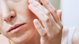 4 sai lầm khiến da khô mốc nứt nẻ ngày hanh khô mà nhiều chị em hay mắc phải