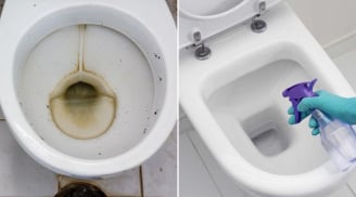 Bồn cầu bị đóng cặn vàng khè, dội thứ nước này, chỉ 15 phút là sạch bẩn