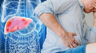 5 loại nước tàn phá gan nhanh hơn cả rượu bia, số 1 nhiều người thích