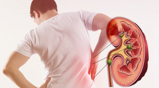 5 dấu hiệu cảnh báo bệnh thận đi vào giai đoạn nặng: Có 1 cũng nên đi khám sớm