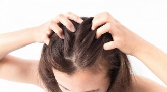 4 mẹo chăm sóc đơn giản nhưng cực hiệu quả giúp bạn “vượt qua mùa tóc bết” một cách nhẹ nhàng.