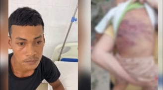 Hé lộ lời khai rợn người của cha dượng trong vụ bé trai 2 tuổi bị bạo hành đến nguy kịch