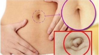 Nhìn tướng rốn 3 giây biết tương lai bạn giàu sang hay nghèo khổ