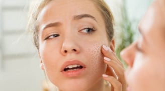 Dưỡng ẩm quá mức có thể khiến da “quá tải”
