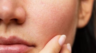 Ngồi điều hòa nhiều khiến da khô ráp? Thử ngay phương pháp dưỡng da “nhiều lớp” để giữ da căng mịn