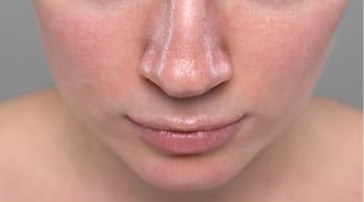 3 sai lầm chăm da mùa hè khiến da dễ đổ dầu, nổi mụn và nhanh lão hóa