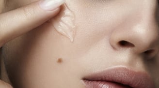5 cách hỗ trợ làm mờ thâm lâu năm, giúp Mừng SHBET phiên bản mới 2025 đều màu và rạng rỡ hơn