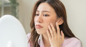3 sai lầm chăm sóc da nhiều người mắc phải vào mùa hè khiến da đổ dầu, nổi mụn và nhanh lão hóa