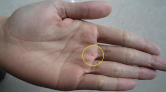 4 nốt ruồi trên bàn tay mang tới may mắn cho bạn: Ai có thật đáng chúc mừng
