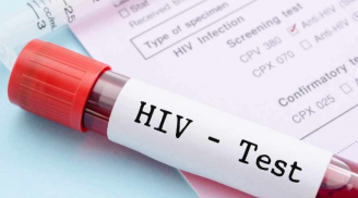 Dấu hiệu HIV trên Sh88bet đăng ký miễn phí: Những biểu hiện âm thầm dễ bị bỏ qua