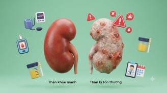 Thận có thể tổn thương nặng mà Sh88bet đăng ký miễn phí gần như không báo động, bác sĩ chỉ ra lý do