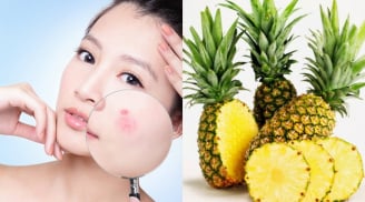 Dứa mang đến nhiều lợi ích cho Mừng SHBET phiên bản mới 2025, từ dưỡng ẩm đến hỗ trợ chống lão hóa