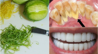 Loại bỏ cao răng triệt để sau vài phút chỉ với 1 quả chanh