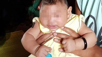 Trẻ bị đầu nhỏ do virus Zika sẽ để lại di chứng gì? và dấu hiệu, cách phòng tránh bệnh