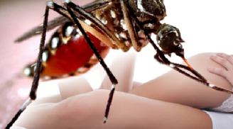 Nóng:  Chàng trai 20 tuổi nhiễm virus Zika do quan hệ tình dục