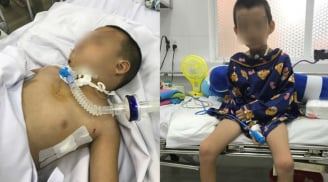 Bác sĩ chia sẻ hành trình giành lại sự sống cho bé trai 5 tuổi té ngã gần đứt lìa cổ họng
