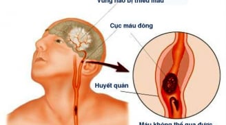 Thức khuya chơi điện tử, nam thanh niên 23 tuổi đột ngột t.ử v.ong và cảnh báo không thể cho qua