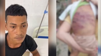 Hé lộ lời khai rợn người của cha dượng trong vụ bé trai 2 tuổi bị bạo hành đến nguy kịch
