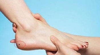 4 nốt ruồi trên bàn chân mang lại may mắn: Đừng dại xóa đi