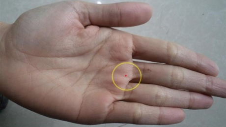 4 nốt ruồi trên bàn tay mang tới may mắn cho bạn: Ai có thật đáng chúc mừng