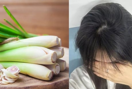 Cách gội đầu bằng sả giúp sạch gàu, tóc lâu bết, tóc con đua nhau mọc
