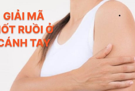 4 nốt ruồi trên cánh tay mang tới may mắn cho bạn: Đừng dại xóa đi