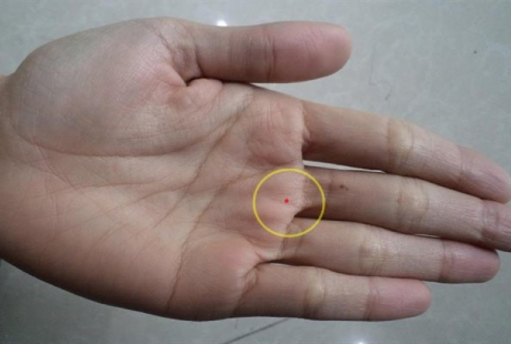4 nốt ruồi trên bàn tay mang tới may mắn cho bạn: Ai có thật đáng chúc mừng